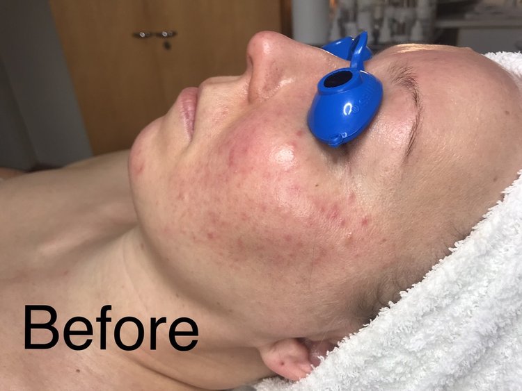 Before image